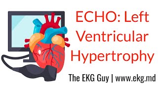 Left ventricular hypertrophy  ECHO Course l The EKG Guy video [upl. by Luis300]