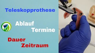 Die Teleskopprothese  Ablauf Termine Dauer und Zeitraum [upl. by Terry772]