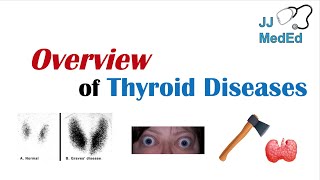 Overview of Thyroid Diseases Hashimoto’s Graves’ Sick Euthyroid Syndrome Toxic adenoma etc [upl. by Kesia]