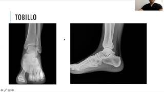 Radiología simple de miembro inferior [upl. by Marcela283]