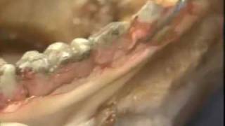 Introductory Periodontal Surgery Techniques Modified Widman Flap [upl. by Boggs]