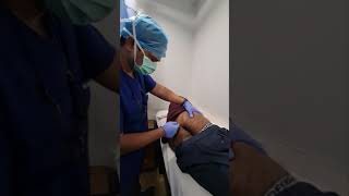 flap surgery recurrence in pilonidal sinus cyst [upl. by Lexine]