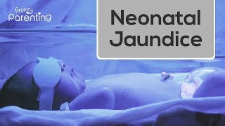 Neonatal Jaundice  Causes Symptoms and Treatment [upl. by Adrell]