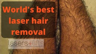 Worlds best hair removal laser [upl. by Madelyn710]