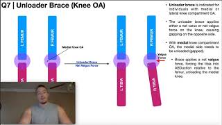 Rebound PostOp Knee – Clinician Fitting instructions [upl. by Ainod]