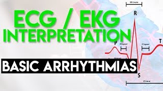 Basic Arrhythmias  Sinus Brady Tachy Premature Beats  ECG EKG Interpretation Part 3 [upl. by Aerdnod]