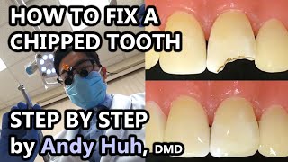 How to fix a chippedbroken tooth dental bonding composite Pasta Evergreen Dental Billerica MA [upl. by Leiso]