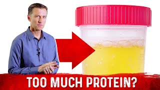 Top 5 Symptoms Of Eating Too Much Protein – DrBerg [upl. by Hylton999]