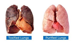 NIH SciBites From Home Treating Lung Scarring With a Bacterial Weed Whacker [upl. by Thurlough]