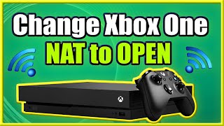 How to Change Xbox One NAT to OPEN and FIX Strict Connection Issues Easy Method [upl. by Norvin]