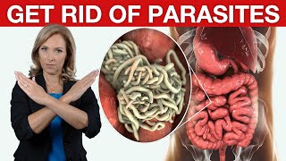 9 Tips to Get Rid of Parasites amp Candida  Dr Janine [upl. by Haneeja959]