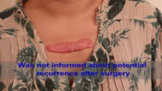 Chest Keloids  Mistakes to Avoid [upl. by Aizahs]