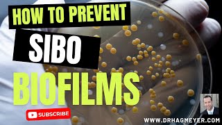 SIBO and Biofilms Why Biofilm Disruptors Are So Important When You Have SIBO [upl. by Solley]