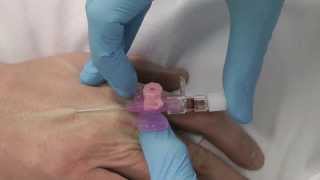 Cannulation How to gain IV access [upl. by Gnuy423]