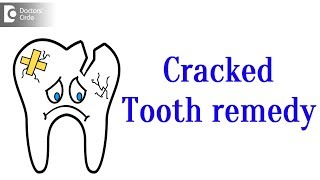 Cracked tooth treatment [upl. by Salman]