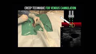 Subclavian Artery  Anatomy Branches amp Relations [upl. by Ecnerwal517]