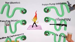 Acute Interstitial Nephritis Mnemonic for the USMLE [upl. by Vashti824]