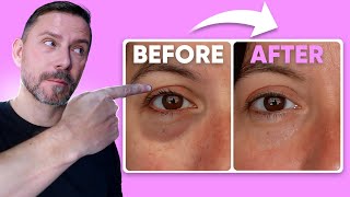 HOW TO MAKE EYE BAGS VANISH IN SECONDS FULL DEMO [upl. by Sivie]