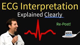 ECG Interpretation Explained Clearly and Succinctly  Arrhythmias Blocks Hypertrophy [upl. by Melisent]