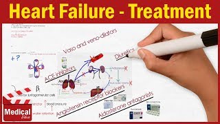 Pharmacology CVS 11 Heart Failure Treatment Part 1 ACE inhibitors  Beta blockers  Diuretics [upl. by Virgilio]