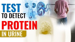 Test to detect Protein in Urine  Proteinuria Test [upl. by Atiuqer144]