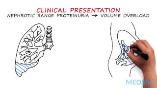 Nephrology – Proteinuria By Manish Suneja MD [upl. by Cesare64]