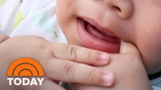 How To Deal With Teething New Baby Basics  TODAY [upl. by Ebony]