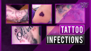 Everything you need to know about tattoo infections [upl. by Enilreug959]