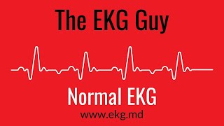 Normal EKG  The EKG Guy  wwwekgmd [upl. by Bobbi]