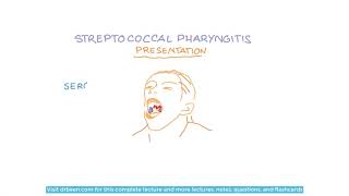 Streptococcus Pyogenes  Diseases and Their Management [upl. by Areivax892]