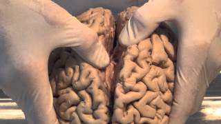 Introduction Neuroanatomy Video Lab  Brain Dissections [upl. by Johnnie807]