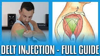 How To Do A Deltoid Injection  Full GuideDemo [upl. by Motteo]