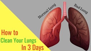 Doctor Explains How to PURIFY Smokers Lungs [upl. by Ecirum]