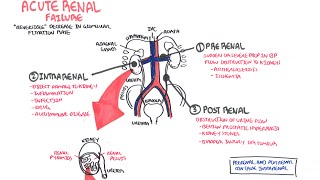 Acute Renal Failure [upl. by Alyakcm]