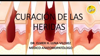 CURACIÓN DE LAS HERIDAS Dr Elmer H Luna Vilchez [upl. by Araeic]