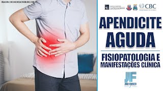 APENDICITE AGUDA Parte 1 Anatomia Epidemiologia e Fisiopatologia 👨🏽‍⚕‍🚑 Joao Fonseca [upl. by Randee]