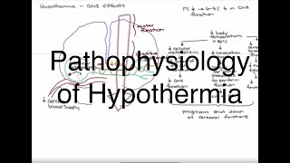 Hypothermia Pathophysiology [upl. by Nywg]