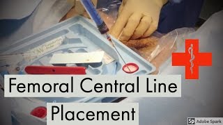 Femoral Arterial Line Placement [upl. by Ydor]