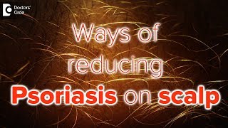 What helps psoriasis on scalp  Dr Rasya Dixit [upl. by Pillow]