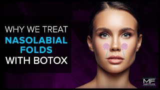 Botox Injections  Anatomy and Technique [upl. by Ecirtac]