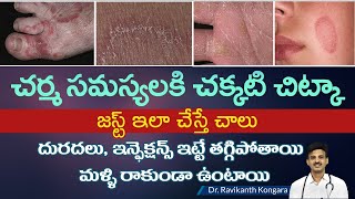 How to Get Relief from Itching  Parasitic Infection  Albendazole Tablets  DrRavikanth Kongara [upl. by Clarisse]