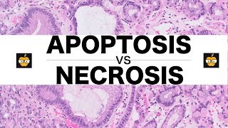 Apoptosis Intrinsic Extrinsic Pathways vs Necrosis [upl. by Miguela786]