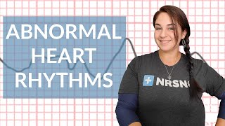 EKG like a BOSS Part 3  Abnormal Heart Rhythms [upl. by Hatch]