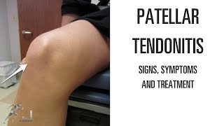 Patellar tendonitis Signs symptoms and remedies for this difficult knee problem [upl. by Teerpnam728]