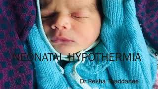 Neonatal Hypothermia  Pediatrics [upl. by Amaty]