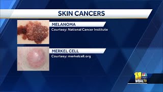 Introduction to Skin Cancer 4 The ABCDEs of Melanoma [upl. by Adnamal434]