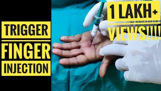 Trigger Finger Injection Technique [upl. by Billmyre]