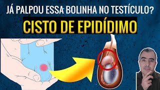 Nódulo no testículo Pode ser cisto de epidídimo [upl. by Nallid]