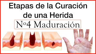 Curación de Heridas Etapa 4 Maduración [upl. by Remus]