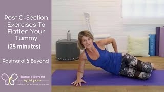 How To Flatten Your Tummy After A C Section  Postnatal Exercises [upl. by Sturdivant223]